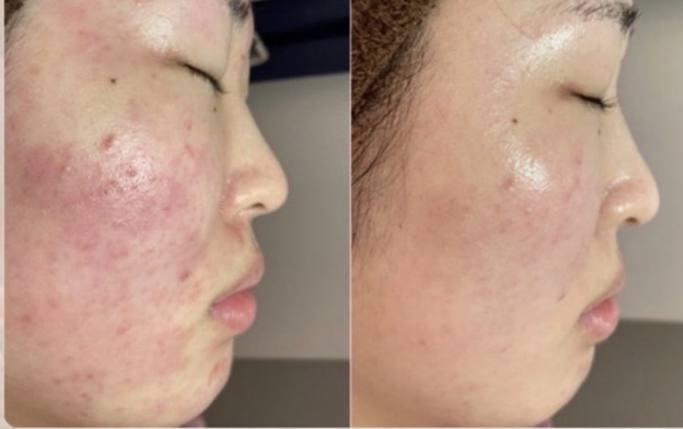 Red&Dark marks serum