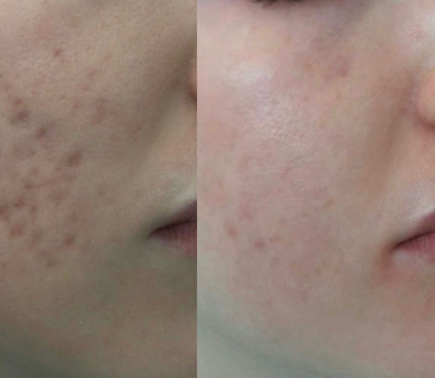 Red&Dark marks serum